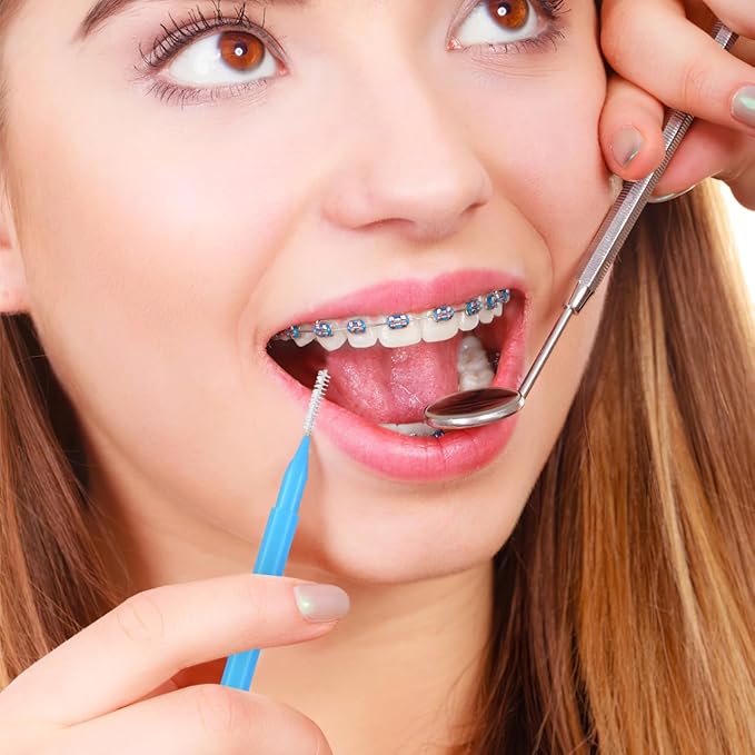 100PCS Braces Brushes Interdental Brushes Braces Flossers Braces Brush for Cleaner Toothpick Dental Flossing Head Oral Flosser Dental Picks for Teeth Cleaning(5colors)