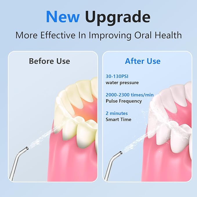 NBGRLVS Water Dental Flosser Cordless - Rechargeable IPX7 Waterproof Teeth Pick Flossing Cleaner,Portable 320ml Tank 6-Mode Oral Irrigator for Teeth/Braces/Tongue,Storage Box for Travel & Home