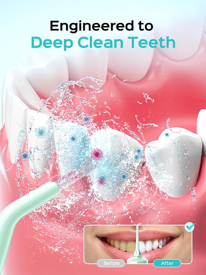 COSLUS Portable Water Flosser for Teeth: 10 Pressure Settings Professional Water Dental Pick for Orthodontic, Braces & Sensitive Gums - Cordless for Travel Use, for Adults Teens, BPA-Free, E40