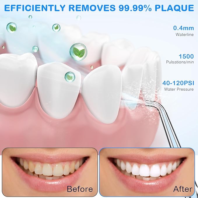 Water Dental Flosser for Teeth Cleaning and Flossing with Travel Size Case โ Rechargeable Oral Irrigator, KOOVON Portable Water Flosser for Adults, IPX7 Waterproof, 5 Jet Tips & 4 Modes, Blue