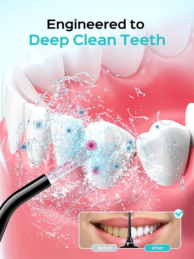 COSLUS Portable Water Flosser for Teeth: 10 Pressure Settings Professional Water Dental Pick for Orthodontic, Braces & Sensitive Gums - Cordless for Travel Use, for Adults Teens, BPA-Free, E40