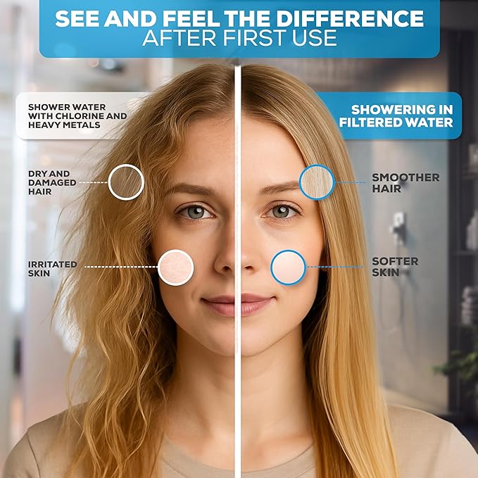 SparkPod Luxury Filtered Shower Head Set 23 Stage Shower Filter - Reduces Chlorine and Heavy Metals - High Pressure Showerhead Filter (6" Round, Brushed Nickel)