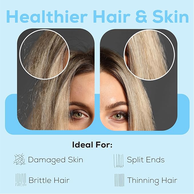 SparkPod 23 Stage Shower Head Filter for Dry Hair and Skin - High Output Universal Shower Filters to Remove Toxic Chemicals, Chlorine & Heavy Metals (Egyptian Gold)