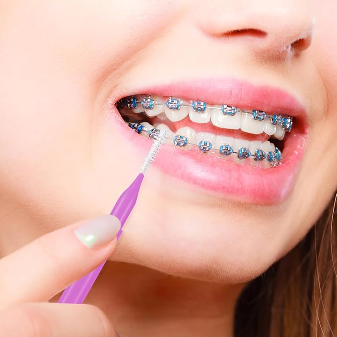 100PCS Braces Brushes Interdental Brushes Braces Flossers Braces Brush for Cleaner Toothpick Dental Flossing Head Oral Flosser Dental Picks for Teeth Cleaning(5colors)