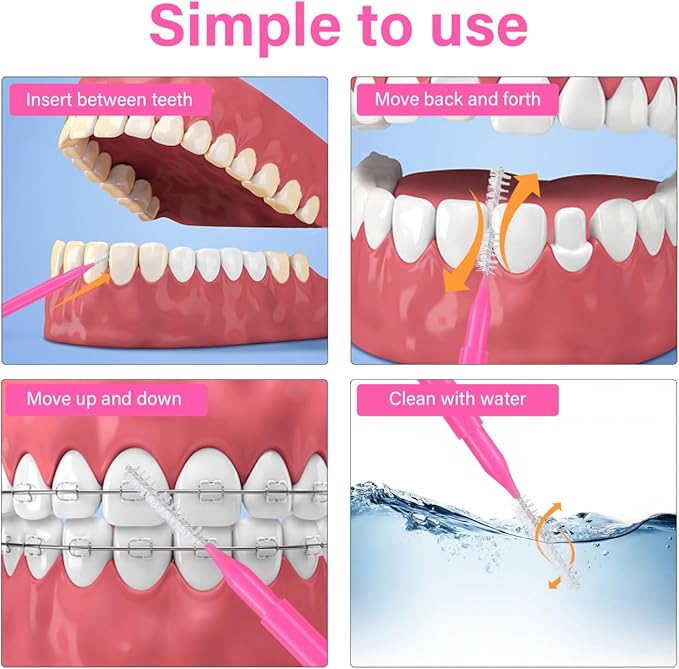 100PCS Braces Brushes Interdental Brushes Braces Flossers Braces Brush for Cleaner Toothpick Dental Flossing Head Oral Flosser Dental Picks for Teeth Cleaning(5colors)