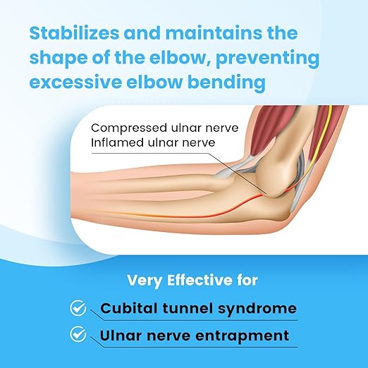 Cubital Tunnel Syndrome Elbow Brace, Ulnar Nerve Entrapment Splint, Elbow Immobilizer for Night Sleeping and Day Working, 4 Angles Adjustable, Fit Women & Men, Right & Left Arm - S