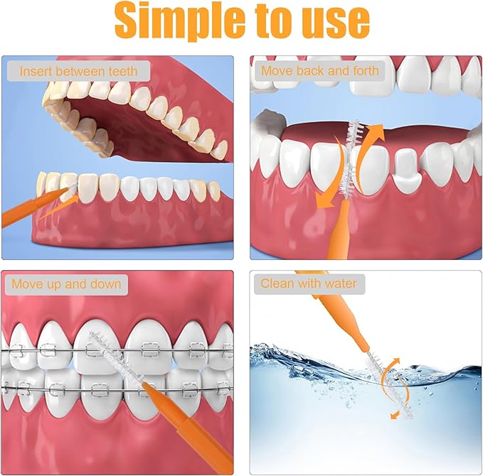 100PCS Braces Brushes Interdental Brushes Braces Flossers Braces Brush for Cleaner Toothpick Dental Flossing Head Oral Flosser Dental Picks for Teeth Cleaning(10 Colors)