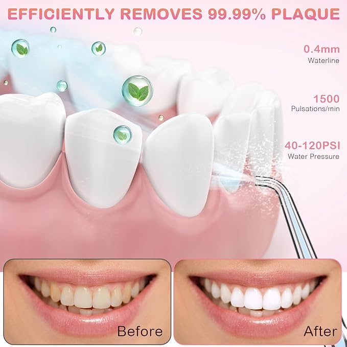 Water Dental Flosser for Teeth Cleaning and Flossing with Travel Size Case – Rechargeable Oral Irrigator, KOOVON Portable Water Flosser for Adults, IPX7 Waterproof, 5 Jet Tips & 4 Modes, Pink