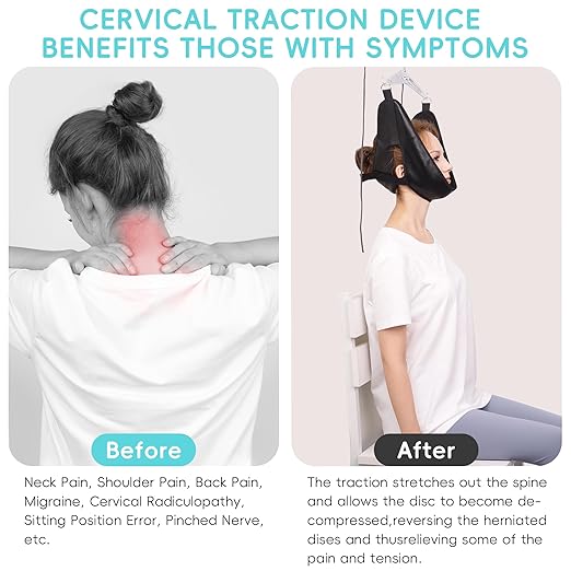 Cervical Neck Traction Device Over-The-Door, No Need for Handheld or Water Bag Portable Neck Stretcher,Effective Home Physical Therapy for Neck Pain Relief, 10 Adjustable Tension Levels