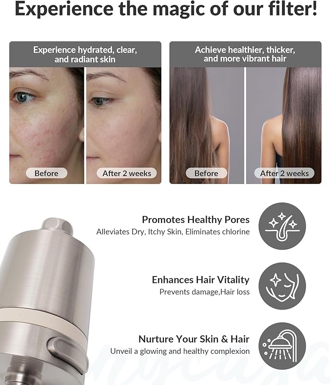 Hard Water Shower Filter - Removes Chlorine, Heavy Metals & Scale - KDF Technology for Softer Skin & Hair - Fits Most Rain & Handheld Showerheads - (BNP Version)