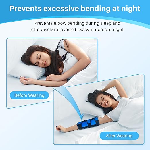 Cubital Tunnel Elbow Splint, Ulnar Nerve Night Brace, for Women & Men, Arm Elbow Splint Support for Left and Right, Built-in 3 Support Plates -L/XL