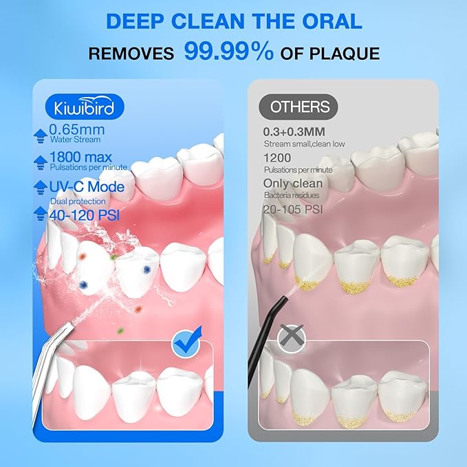 KIWIBIRD Water Dental Flosser Cordless with UVC Light, 3 Modes Portable Oral Irrigator, IPX7 Waterproof, 300ML Tank, Electric Teeth Cleaner for Tonsil Stones, Home & Travel Use (Black & White)