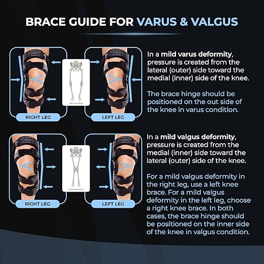 Z1 K8 Eco Assist OA Unloader Knee Brace - Support for Osteoarthritis - Bone on Bone & Rheumatoid Arthritis Knee Joint Pain Relief and Degeneration - Cartilage Defect Repair (Medial Left)